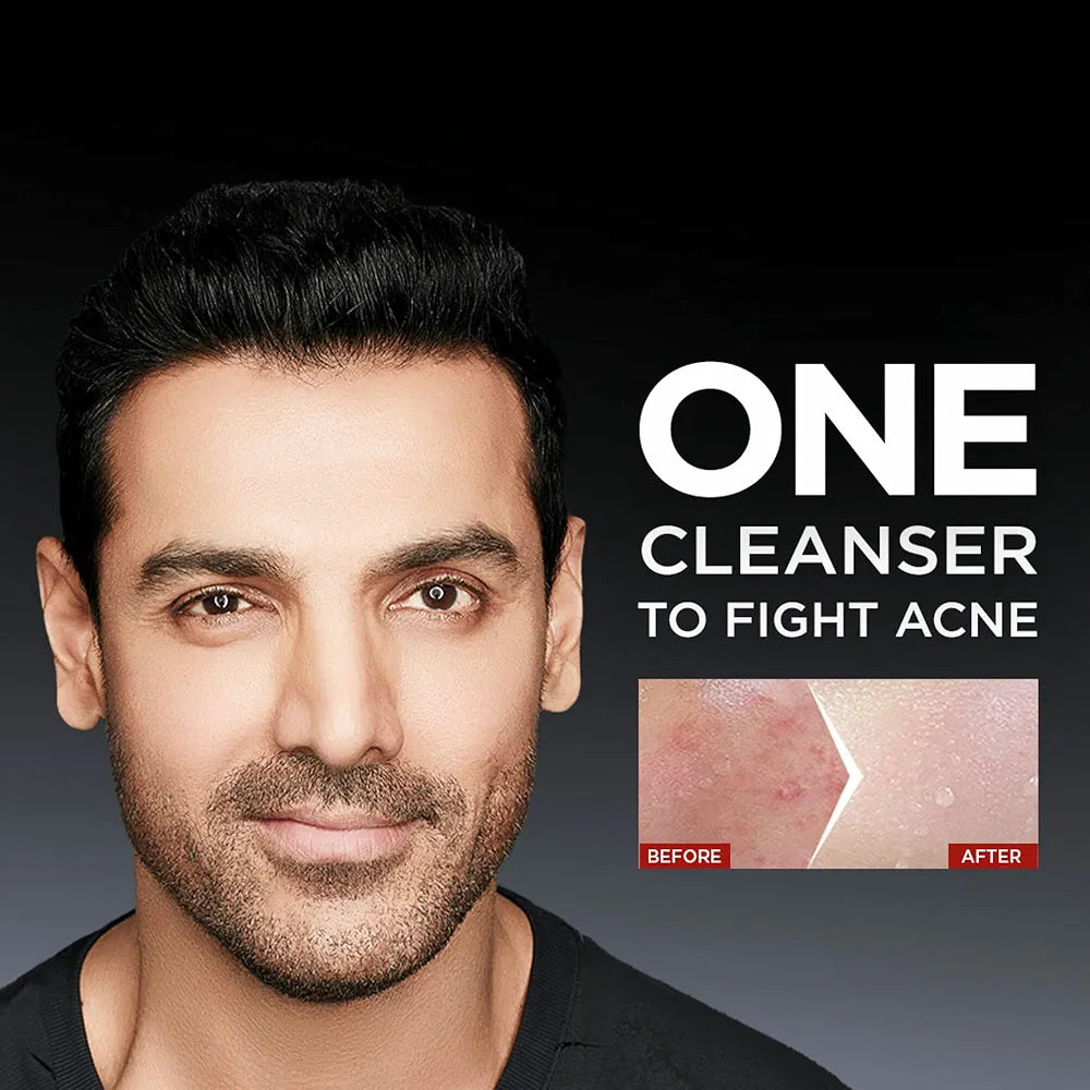 GARNIER 50ML ANTI PIMPLE ACNO FIGHT